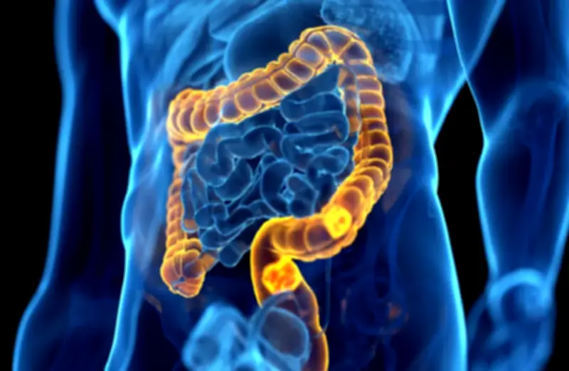 علماء كوريون يكتشفون طريقة واعدة لإبطاء نمو سرطان القولون